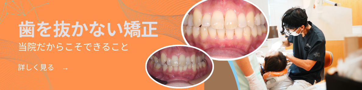 シークエンシャル咬合について